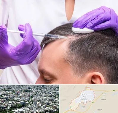 دکتر فوق تخصص پوست و مو در شاهرود