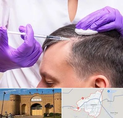 دکتر فوق تخصص پوست و مو در ایرانشهر