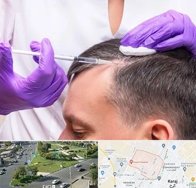 دکتر فوق تخصص پوست و مو در شاهین ویلا کرج 