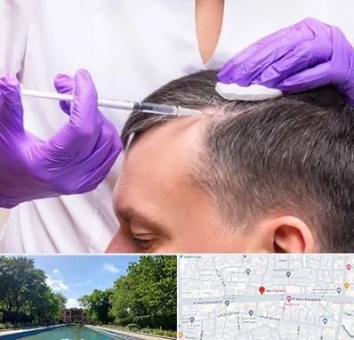 دکتر فوق تخصص پوست و مو در هشت بهشت اصفهان 