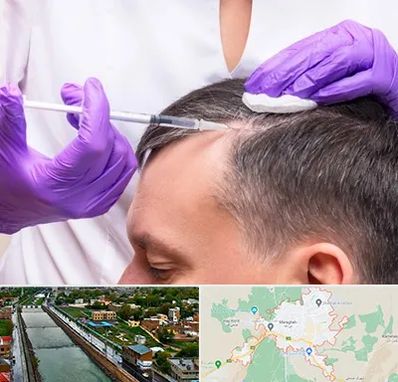 دکتر فوق تخصص پوست و مو در مراغه