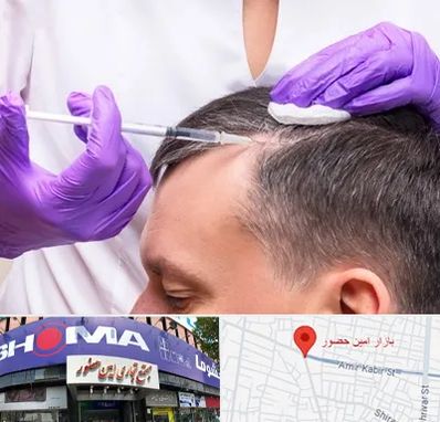 دکتر فوق تخصص پوست و مو در امین حضور