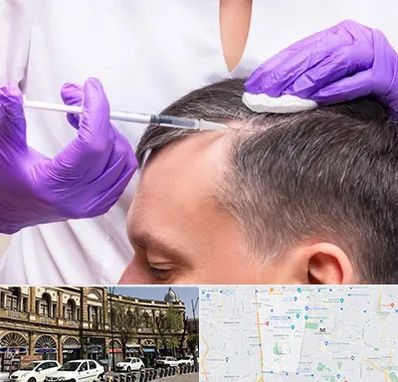 دکتر فوق تخصص پوست و مو در منطقه 11 تهران 