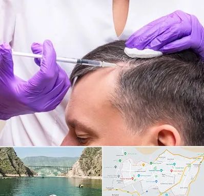 دکتر فوق تخصص پوست و مو در ایلام