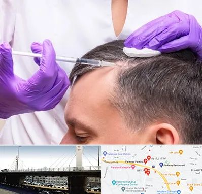 دکتر فوق تخصص پوست و مو در پارک وی 