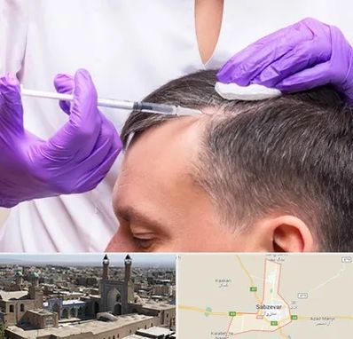 دکتر فوق تخصص پوست و مو در سبزوار