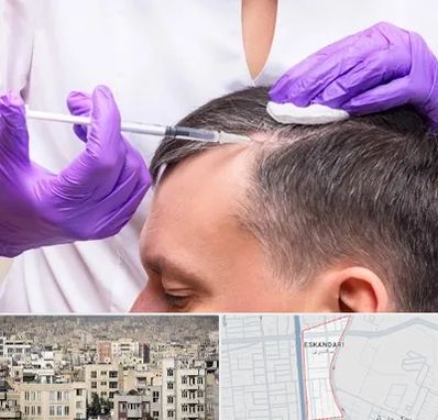 دکتر فوق تخصص پوست و مو در اسکندری