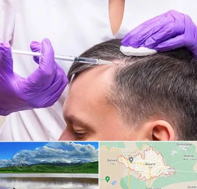 دکتر فوق تخصص پوست و مو در مرند