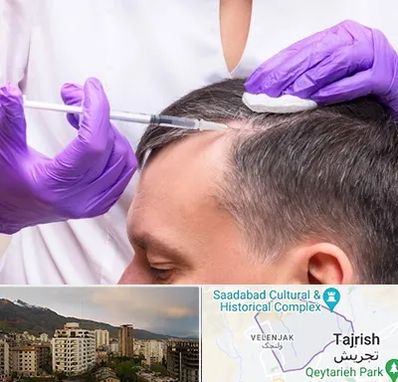 دکتر فوق تخصص پوست و مو در زعفرانیه 