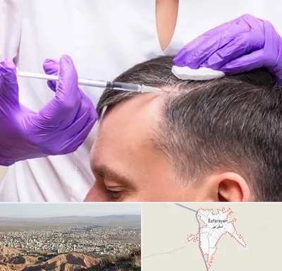 دکتر فوق تخصص پوست و مو در اسفراین