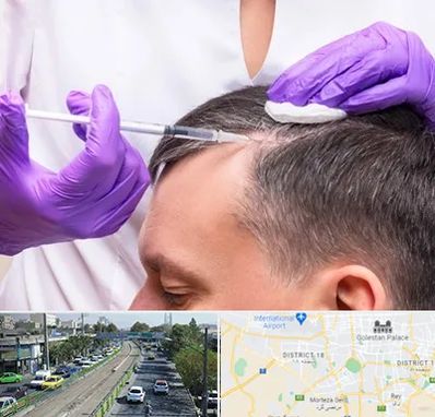 دکتر فوق تخصص پوست و مو در جنوب تهران 