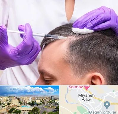 دکتر فوق تخصص پوست و مو در میانه