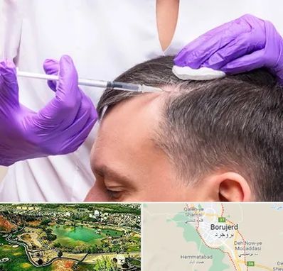 دکتر فوق تخصص پوست و مو در بروجرد