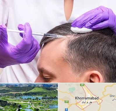 دکتر فوق تخصص پوست و مو در خرم آباد