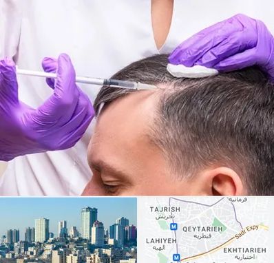 دکتر فوق تخصص پوست و مو در قیطریه 