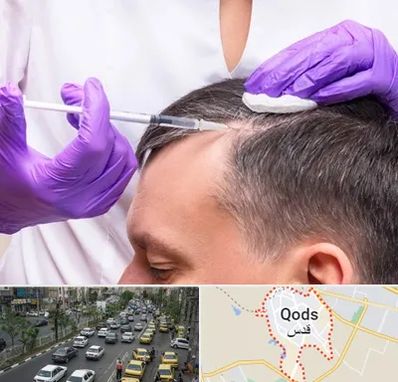 دکتر فوق تخصص پوست و مو در شهر قدس