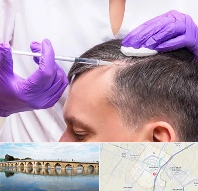 دکتر فوق تخصص پوست و مو در فلاورجان