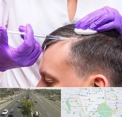 دکتر فوق تخصص پوست و مو در منطقه 17 تهران 