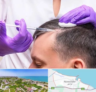 دکتر فوق تخصص پوست و مو در نوشهر