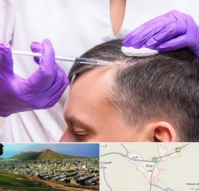 دکتر فوق تخصص پوست و مو در بیجار