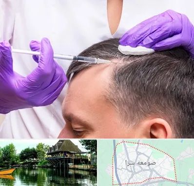 دکتر فوق تخصص پوست و مو در صومعه سرا