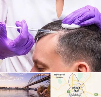 دکتر فوق تخصص پوست و مو در اهواز