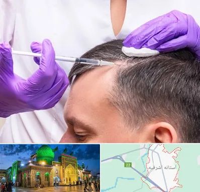 دکتر فوق تخصص پوست و مو در آستانه اشرفیه