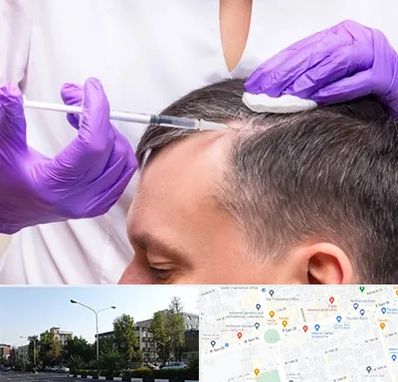 دکتر فوق تخصص پوست و مو در میدان کاج 