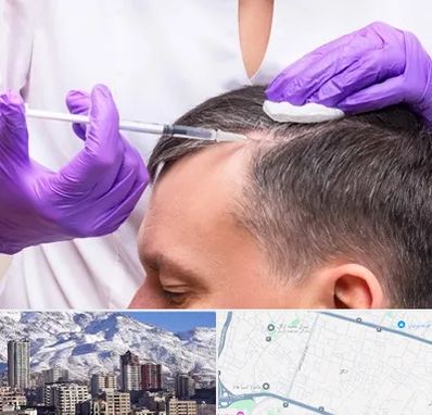 دکتر فوق تخصص پوست و مو در ازگل