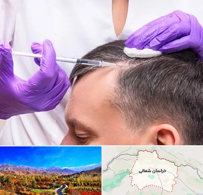 دکتر فوق تخصص پوست و مو در خراسان شمالی