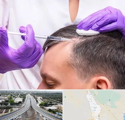 دکتر فوق تخصص پوست و مو در اندیمشک