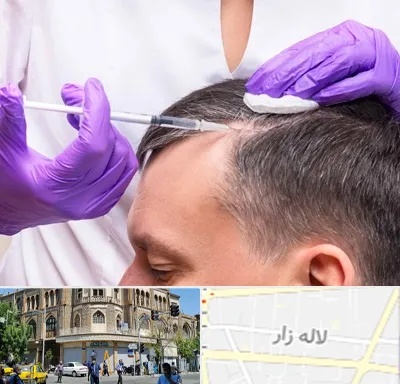دکتر فوق تخصص پوست و مو در لاله زار