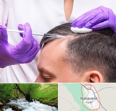دکتر فوق تخصص پوست و مو در نهاوند