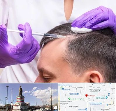 دکتر فوق تخصص پوست و مو در کارگر جنوبی 