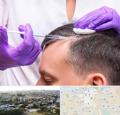 دکتر فوق تخصص پوست و مو در منطقه 20 تهران 