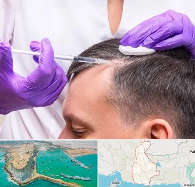 دکتر فوق تخصص پوست و مو در سیستان و بلوچستان