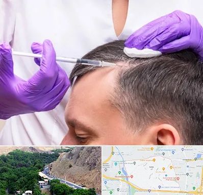 دکتر فوق تخصص پوست و مو در کن 