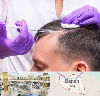 دکتر فوق تخصص پوست و مو در بانه