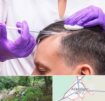 دکتر فوق تخصص پوست و مو در آزادشهر
