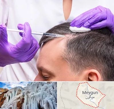 دکتر فوق تخصص پوست و مو در میگون