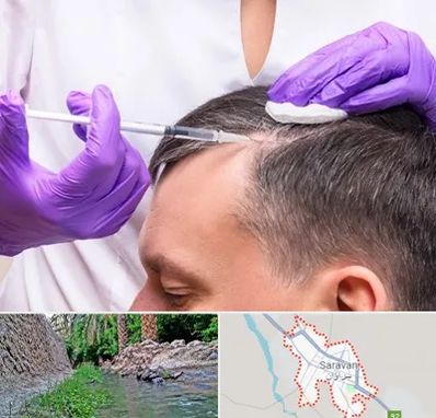 دکتر فوق تخصص پوست و مو در سراوان