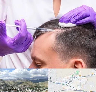 دکتر فوق تخصص پوست و مو در رودهن