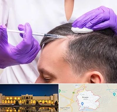 دکتر فوق تخصص پوست و مو در برازجان