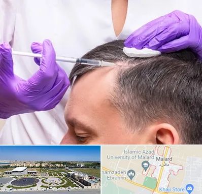 دکتر فوق تخصص پوست و مو در ملارد