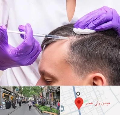 دکتر فوق تخصص پوست و مو در ولیعصر شهریار