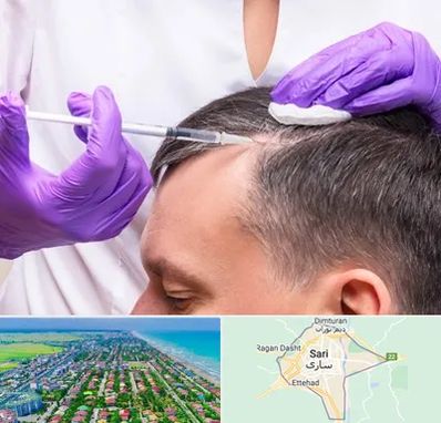 دکتر فوق تخصص پوست و مو در ساری