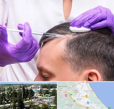 دکتر فوق تخصص پوست و مو در رودسر