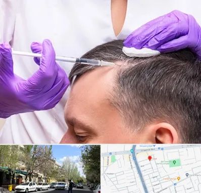 دکتر فوق تخصص پوست و مو در کوی فیروز تبریز