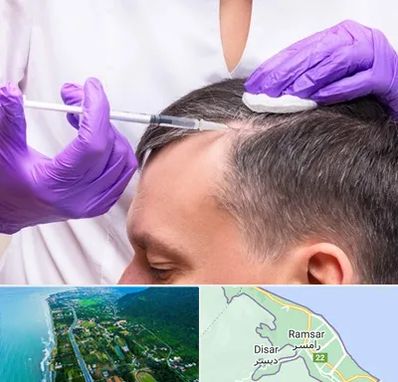 دکتر فوق تخصص پوست و مو در رامسر