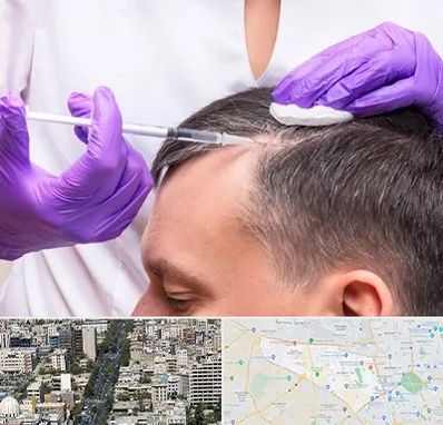 دکتر فوق تخصص پوست و مو در منطقه 18 تهران 